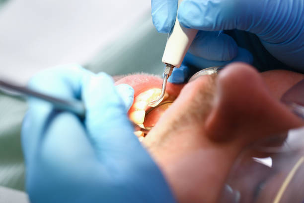 Best Emergency Tooth Extraction in Liberty, NC