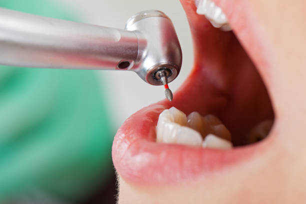 Best Emergency Dental Care for Broken or Chipped Teeth in Liberty, NC